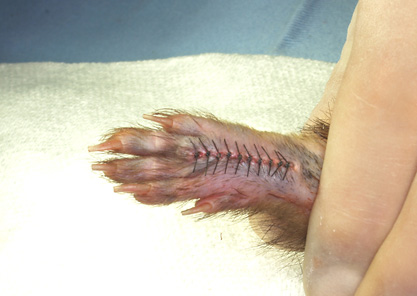 手の甲の腫瘍