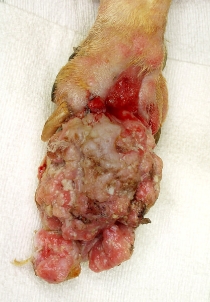 手の腫瘍