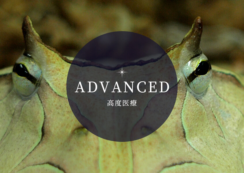 ADVANCED 高度医療