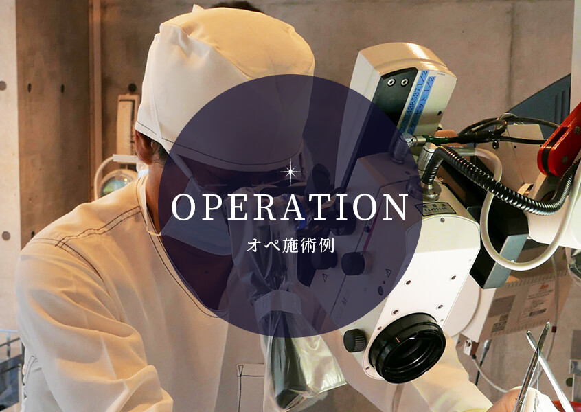 OPERATION オペ施術例